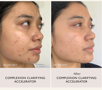 Sachi Skin Complexion Clarifying Accelerator