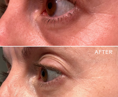 EyeHero Bio-Retinol Smoothing Eye Cream